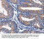 Rabbit anti-human PLEKHO1 polyclonal antibody