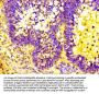 C3 Antibody