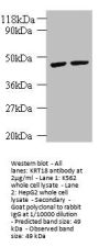 KRT18 Antibody