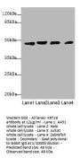 KRT18 Antibody