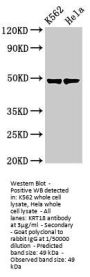 KRT18 Antibody