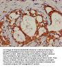 KRT18 Antibody
