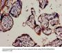 KRT18 Antibody
