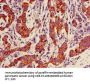 KRT18 Antibody, Biotin conjugated
