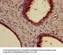 KRT18 Antibody, Biotin conjugated