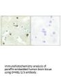 EPHB1/EPHB2/EPHB3 Antibody