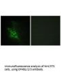 EPHB1/EPHB2/EPHB3 Antibody