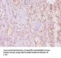 MUC16 Antibody