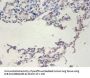 TERT Antibody