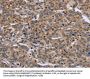 ETV7 Antibody