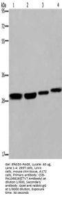 ETV7 Antibody