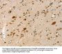 GNB2L1 Antibody