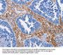 Rabbit anti-human PLK1 polyclonal antibody