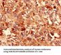 CDH3 Antibody
