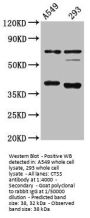 CTSS Antibody