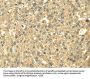 SDHA Antibody