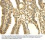 SDHA Antibody