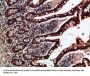 GREM2 Antibody
