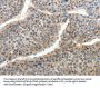HTR3A Antibody