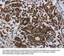 IL31RA Antibody