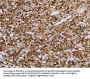 IL31RA Antibody