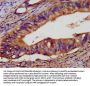 EPCAM Antibody