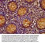 EPCAM Antibody