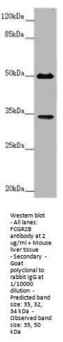 FCGR2B Antibody