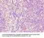 FCGR2B Antibody