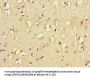 FCGR2B Antibody