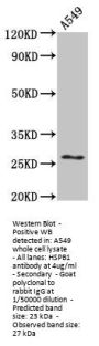 HSPB1 Antibody