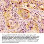 HSPB1 Antibody