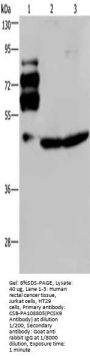 PCSK9 Antibody
