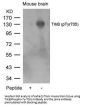 Phospho-NTRK2 (Tyr705) Antibody