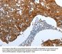 CEACAM5 Antibody