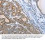 CEACAM5 Antibody