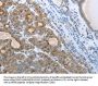 CEACAM5 Antibody