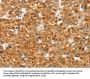 CCS Antibody