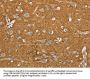 SLC1A2 Antibody