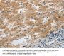 SLC1A2 Antibody