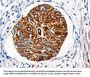 HTR1A Antibody