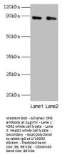 CFB Antibody