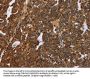 NEFH Antibody
