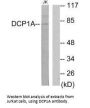 DCP1A Antibody
