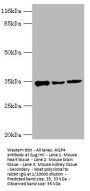 AQP4 Antibody