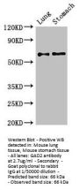GAD2 Antibody