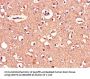 MAPT Antibody
