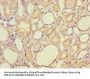 HAGH Antibody