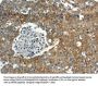 Rabbit anti-human ABCC10 polyclonal antibody