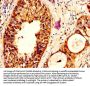 SERPINB3 Antibody
